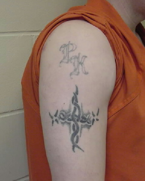 Allen Hurst 100277 upper right arm