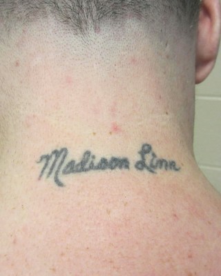 Cohagen Back of Neck