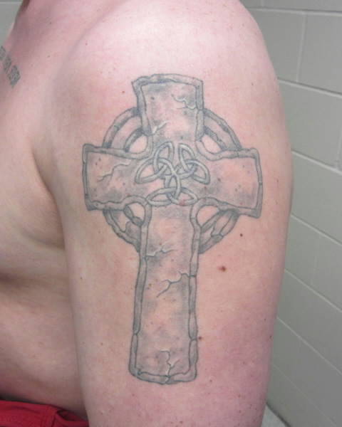 Sean McKenzie-left shoulder