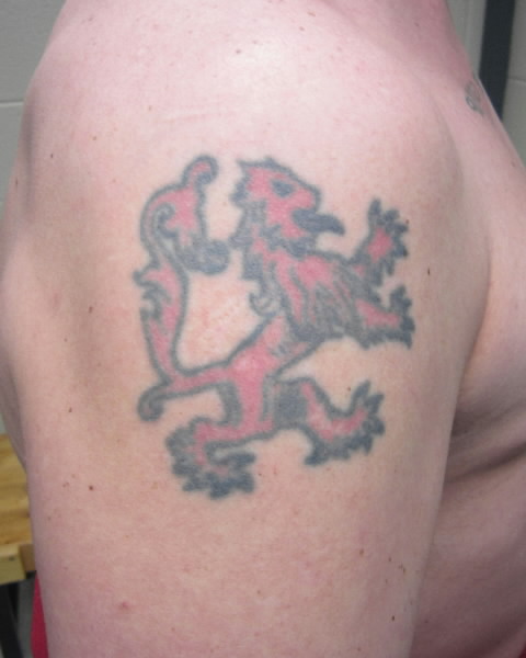 Sean McKenzie - right shoulder